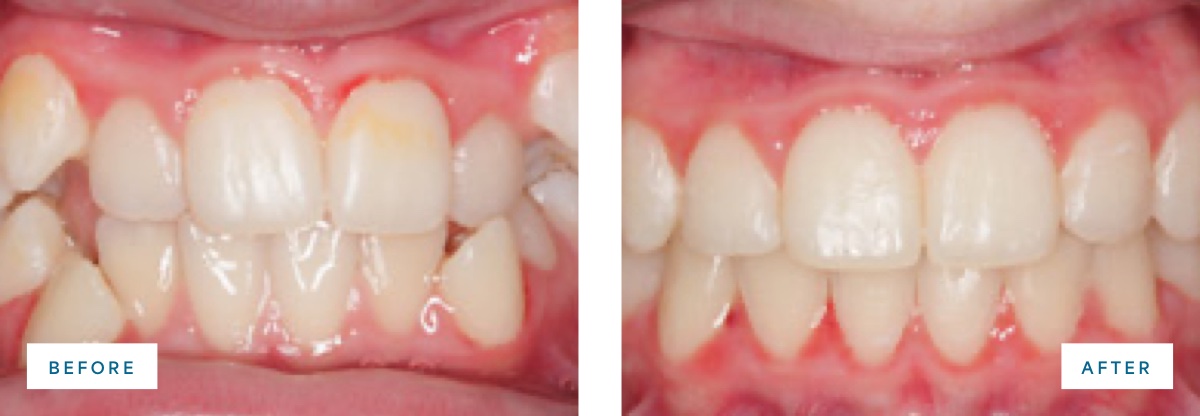 before and after photo