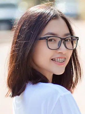 Traditional Braces